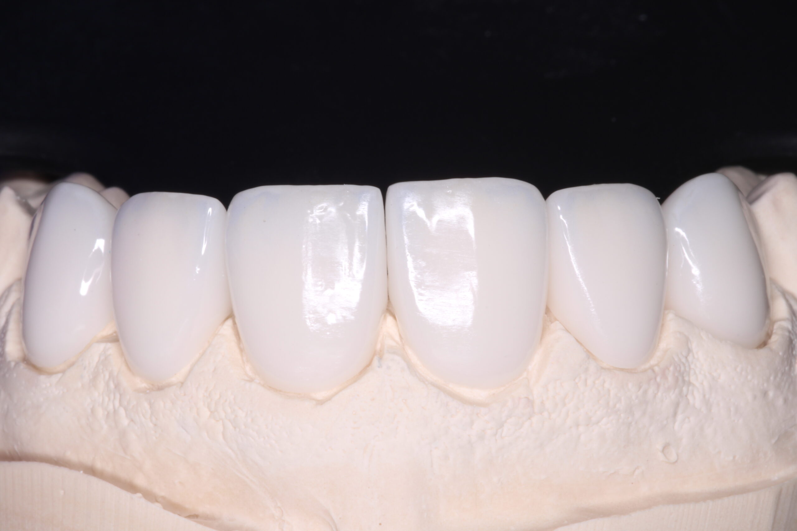 Cosmetic Dentistry mage